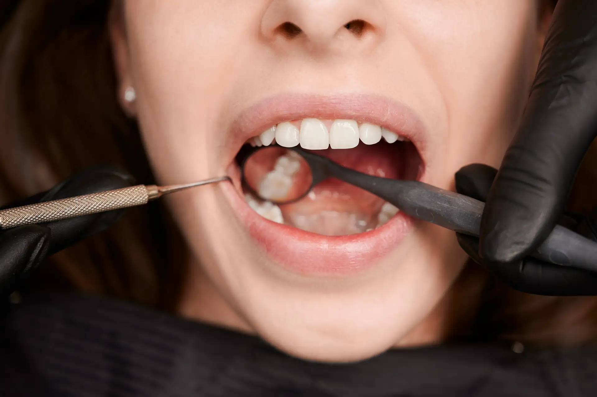 Cirurgia Plástica Periodontal