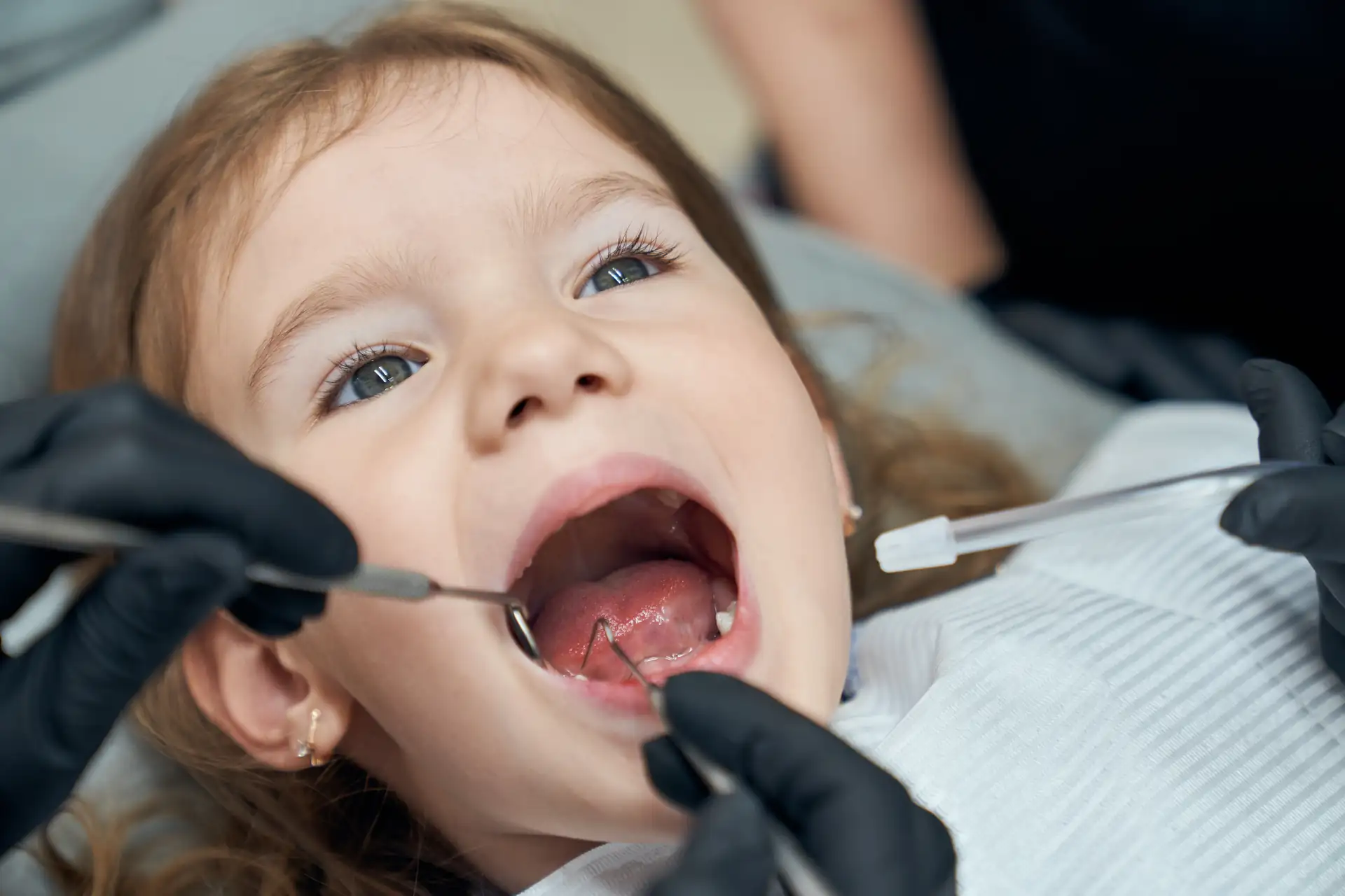 Tratamento de Cárie Infantil